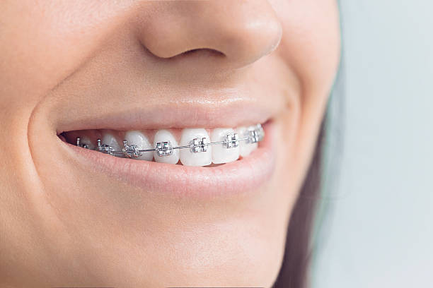 Dental Bonding in Collinsville, MS